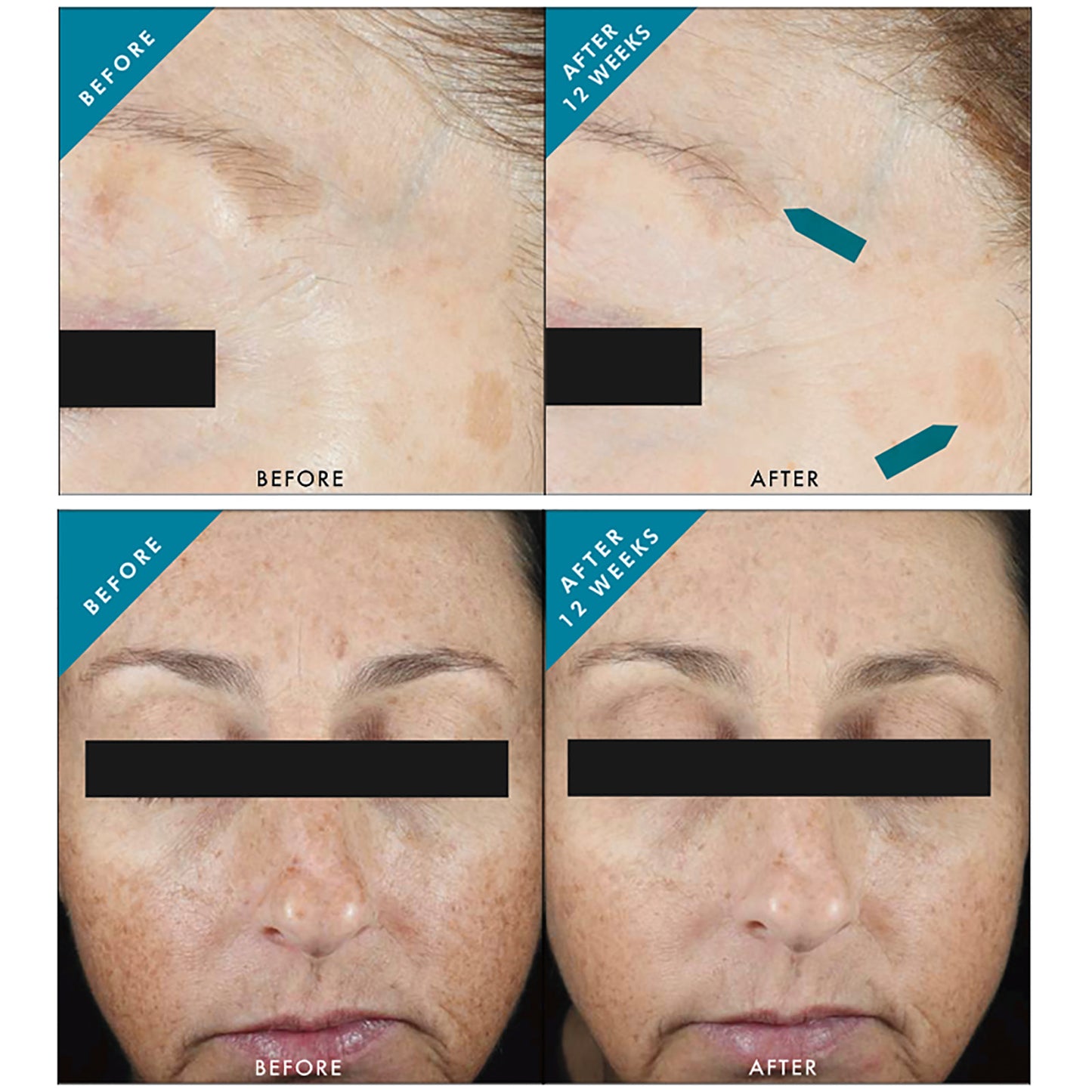 SkinCeuticals Advanced Pigment Corrector