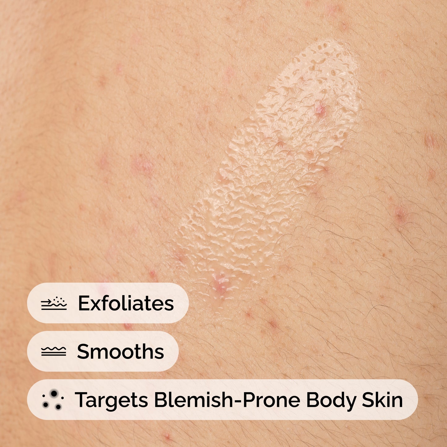 The Ordinary Salicylic Acid 0.5% Body Serum 240ml