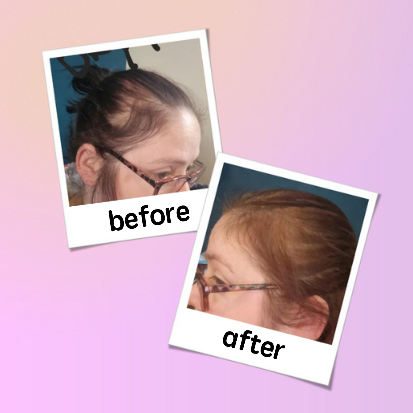 georgiemane Scalp Scrub 150ml