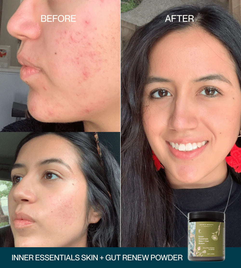 Edible Beauty Inner Essentials - Skin + Gut Renew Powder 120g