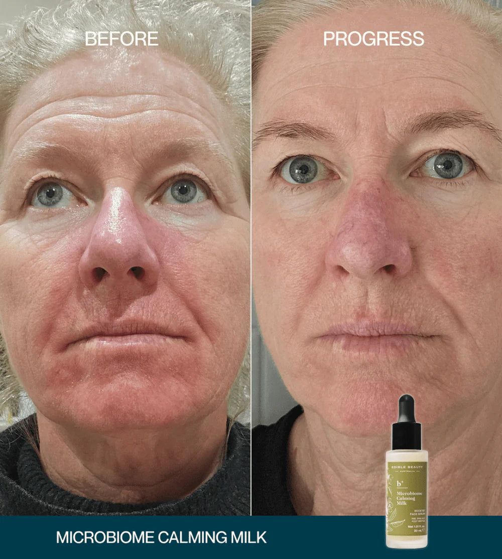 Edible Beauty Microbiome Calming Milk 30ml