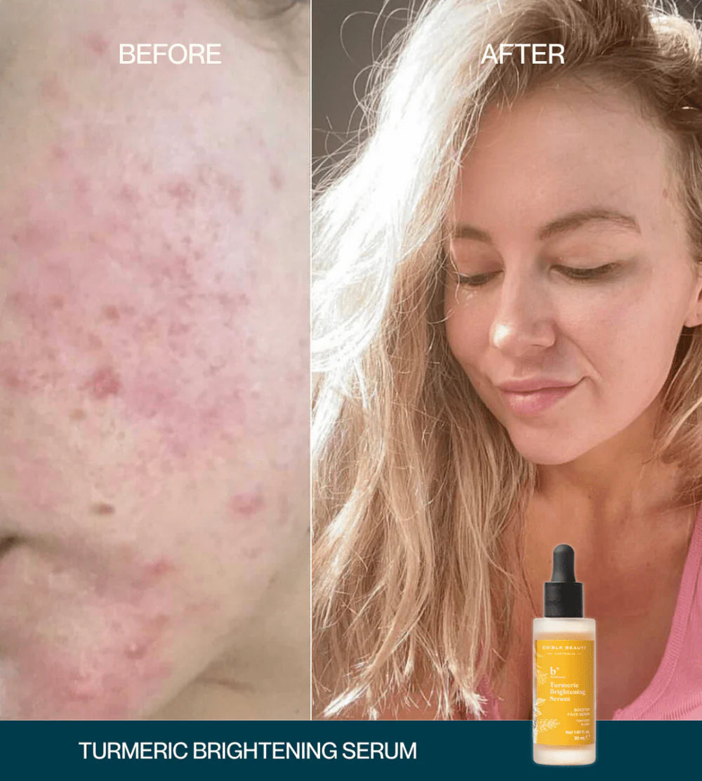 Edible Beauty Turmeric Brightening Serum 30ml