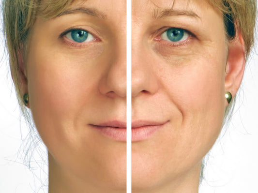 Give Your Skin a Firm Up - FAST!