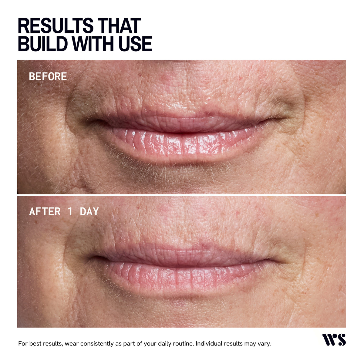 Wrinkles Schminkles Mouth and Lip Wrinkle Patches - 2 Patches