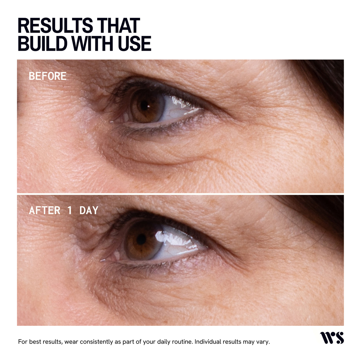 Wrinkles Schminkles Eye Wrinkle Patches - 1 Pair