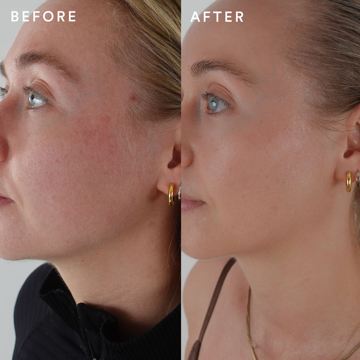 The Beauty Chef Glow - before and after results