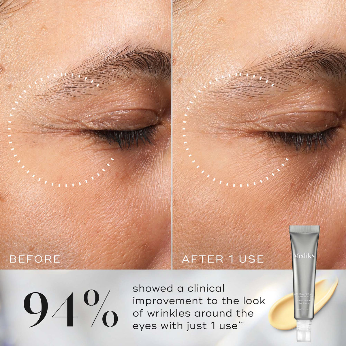 Medik8 Crystal Retinal Ceramide Eye 3 – Retinal Eye Cream 15ml - B&A