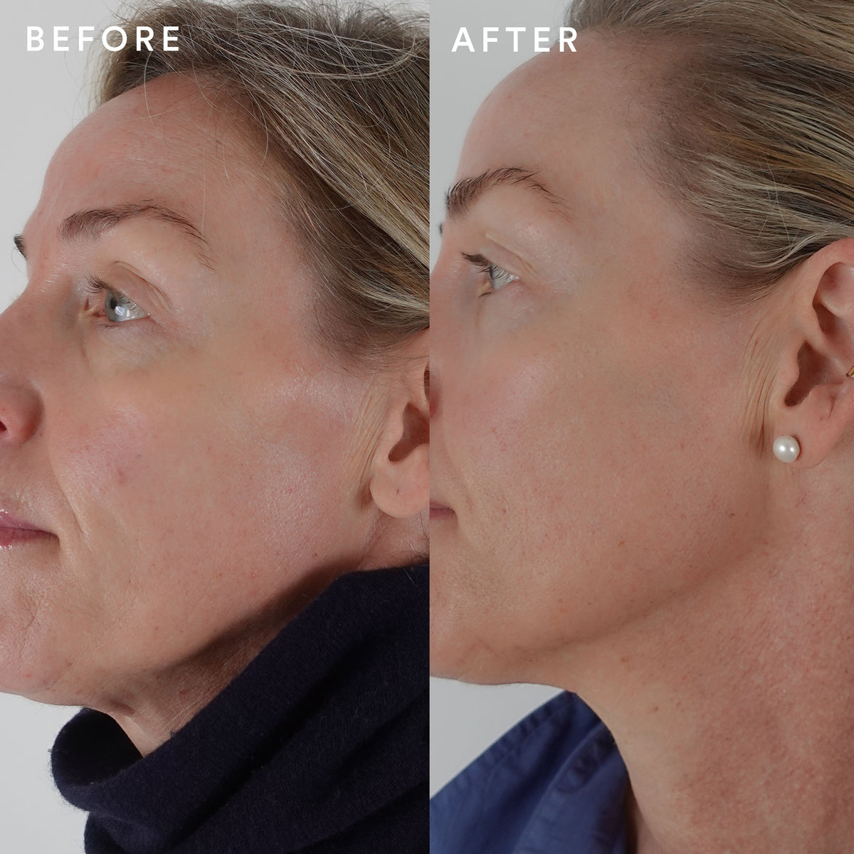 The Beauty Chef Glow Ageless - before and after results