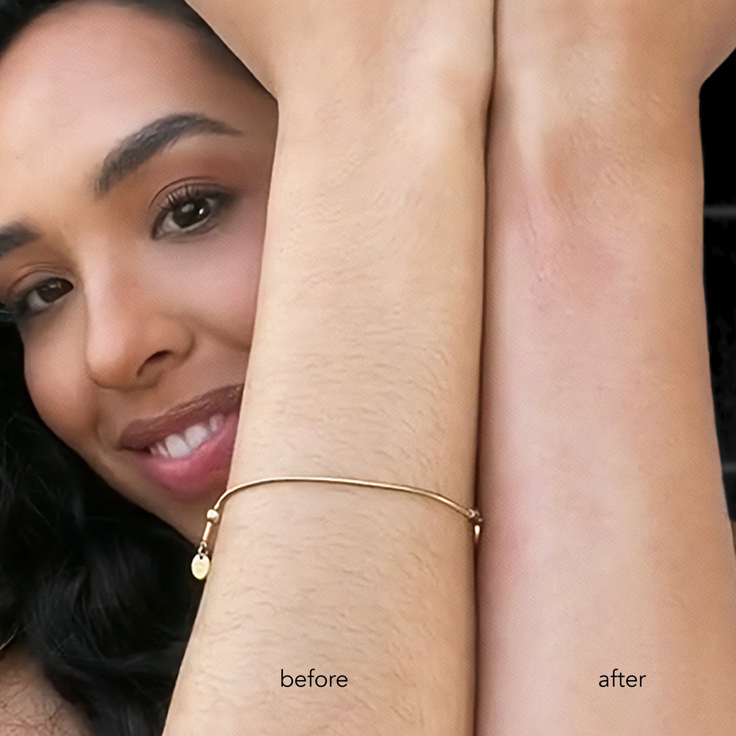 ANSWR Exfoliating Hair Removal Drop