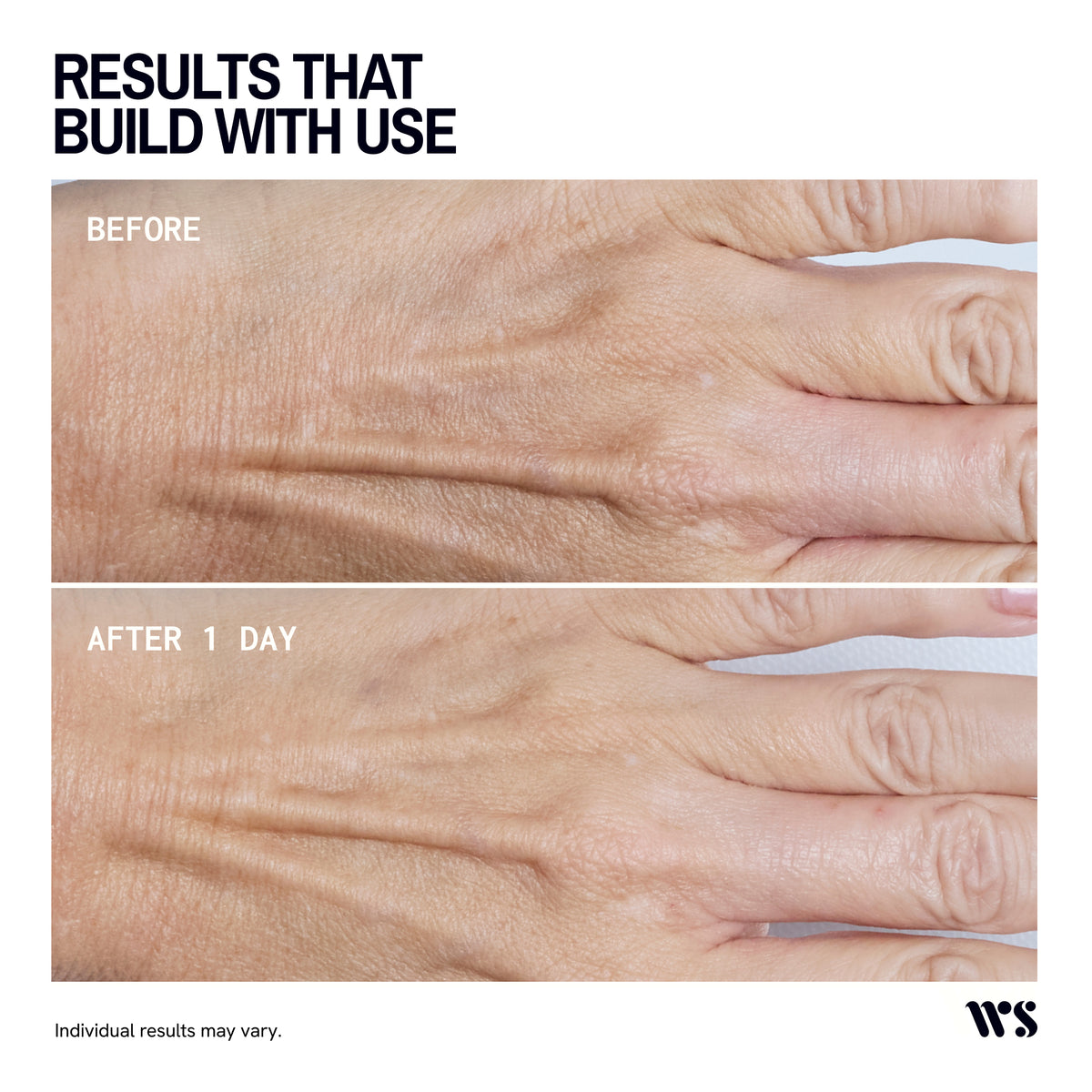 Wrinkles Schminkles Hand Smoothing Patches - 1 Pair