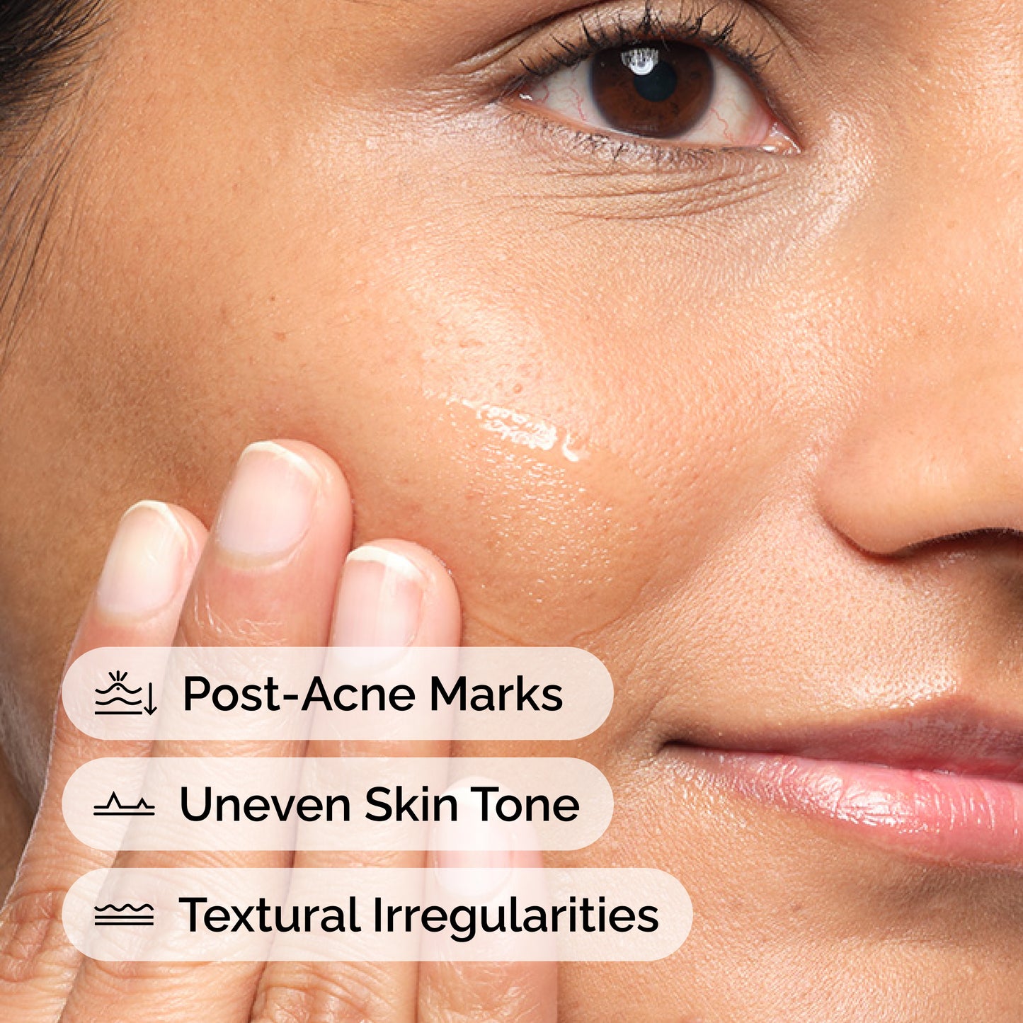 The Ordinary Aloe 2% + NAG 2% 30ml