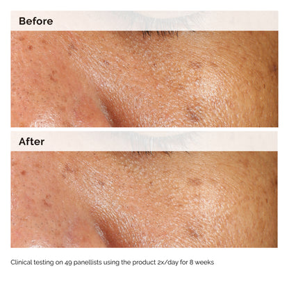 The Ordinary Alpha Arbutin 2% + HA 60ml