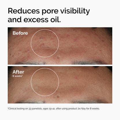 The Ordinary Niacinamide 10% + Zinc 1% 30ml