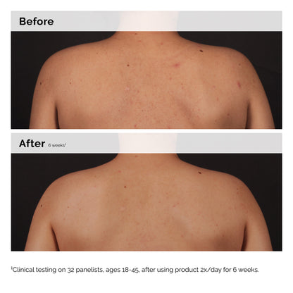 The Ordinary Salicylic Acid 0.5% Body Serum 240ml