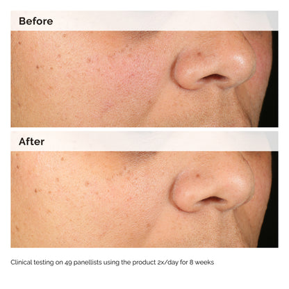 The Ordinary Alpha Arbutin 2% + HA 30ml