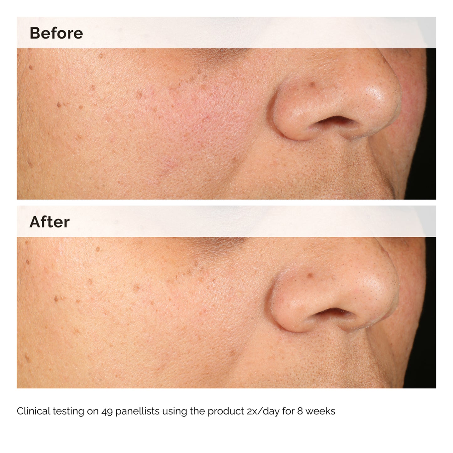 The Ordinary Alpha Arbutin 2% + HA 60ml