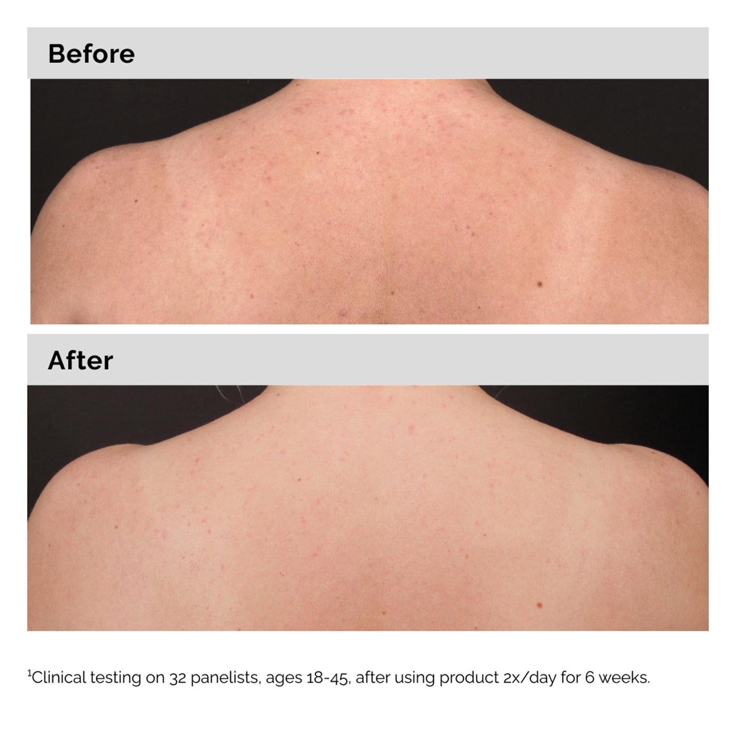 The Ordinary Salicylic Acid 0.5% Body Serum 240ml