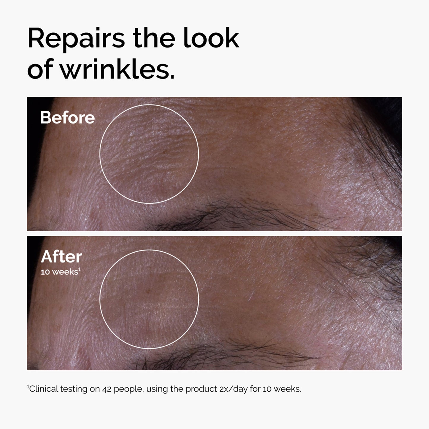 The Ordinary GF 15% Solution 30ml