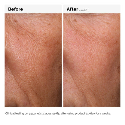 The Ordinary Hyaluronic Acid 2% + B5 30ml