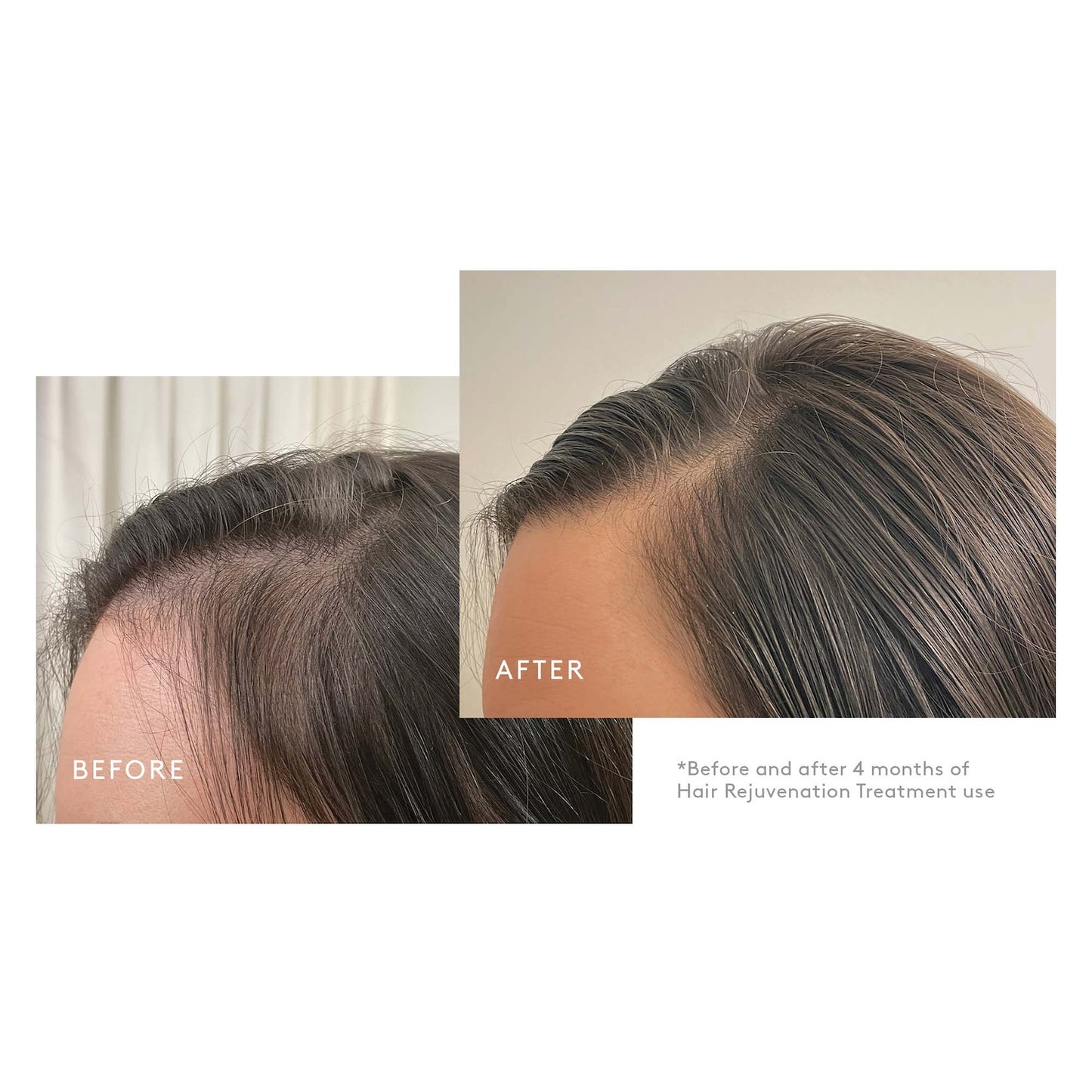 Virtue Flourish Hair Rejuvenation Treatment Kit (Phyto-Follicle Nutrient) - Travel Size (30 day)