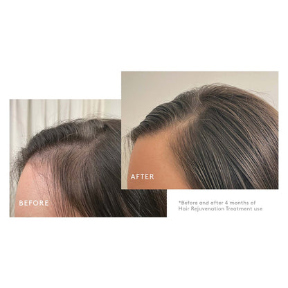 Virtue Flourish Hair Rejuvenation Treatment Kit (Phyto-Follicle Nutrient) - Travel Size (30 day)