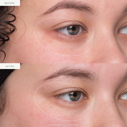 KORA Organics Kakadu Plum Vit C Eye Cream Jar 15ml