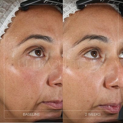 Ultraceuticals Ultra Brightening Serum 30ml