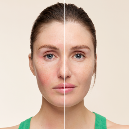 Embryolisse SOS Corrective Cream 30ml