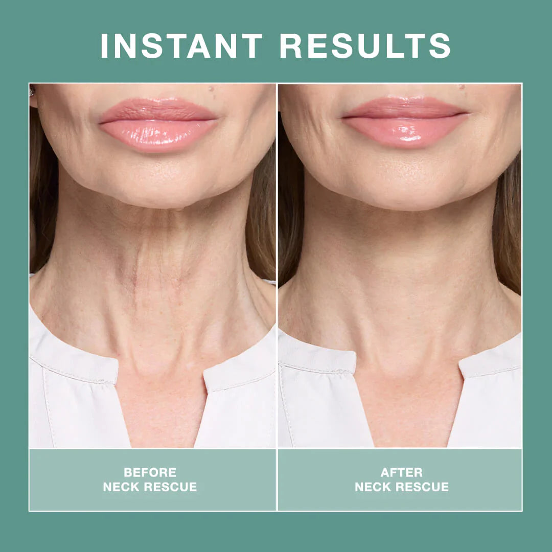 Contours Rx NECK RESCUE 30 Strips