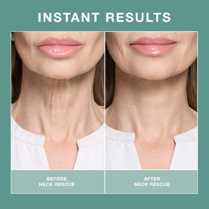 Contours Rx NECK RESCUE 30 Strips