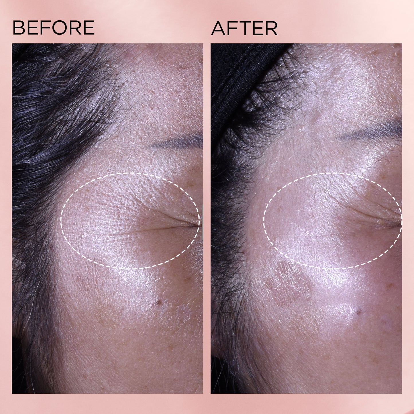 Elizabeth Arden Retinol + HPR Ceramide Capsules Rapid Skin Renewing Serum 90 Piece