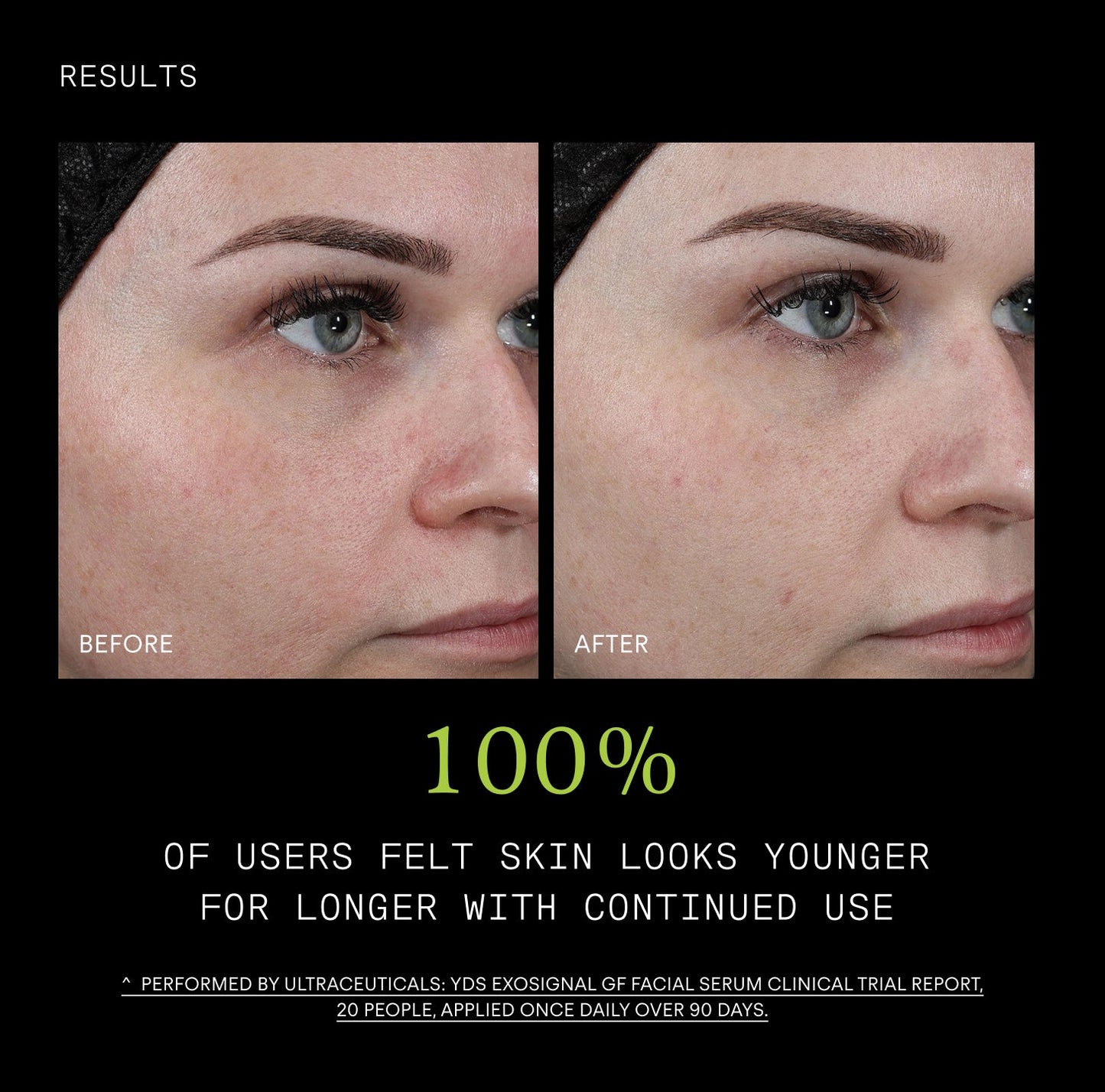 Ultraceuticals Youth Booth ExoSignal GF² Facial Serum 30mL