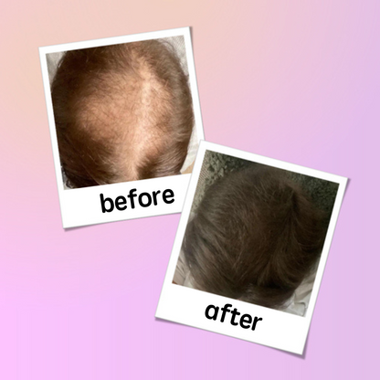 georgiemane Hair Growth Spray 100ml