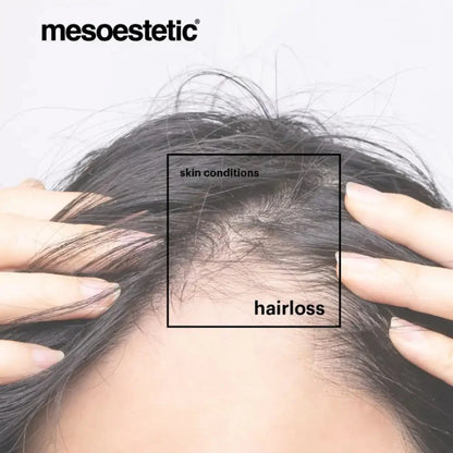 Mesoestetic Tricology Shampoo 225ml