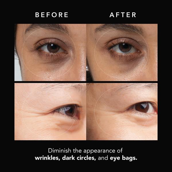 FOREO FAQ Under Eye Microneedling Anti-Wrinkle Hyaluronic Acid Patches 3 Pairs