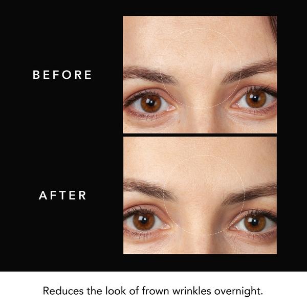 FOREO FAQ Forehead Microneedling Anti-Wrinkle Hyaluronic Acid Patches 3 Patches