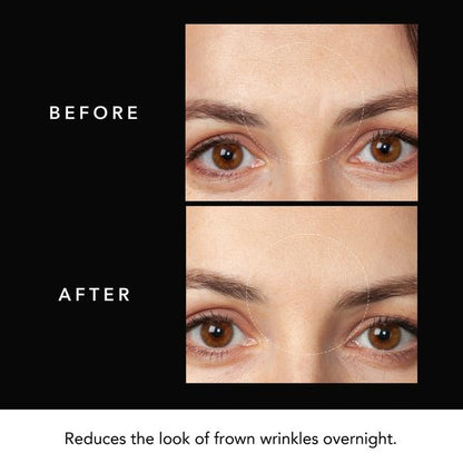 FOREO FAQ Forehead Microneedling Anti-Wrinkle Hyaluronic Acid Patches 3 Patches