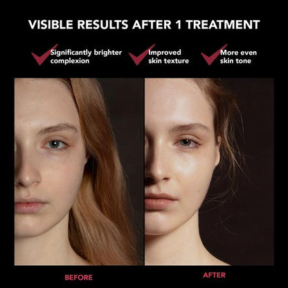 FOREO FAQ 201 LED Face Mask