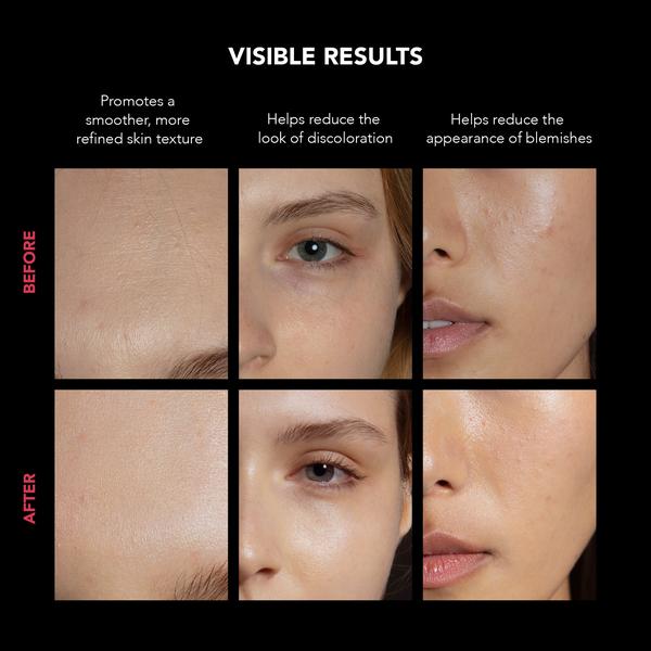 FOREO FAQ 202 LED Face Mask