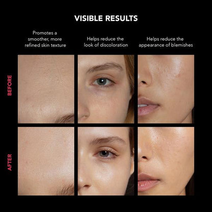 FOREO FAQ 202 LED Face Mask