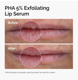 The Ordinary PHA 5% Exfoliating Lip Serum 15ml