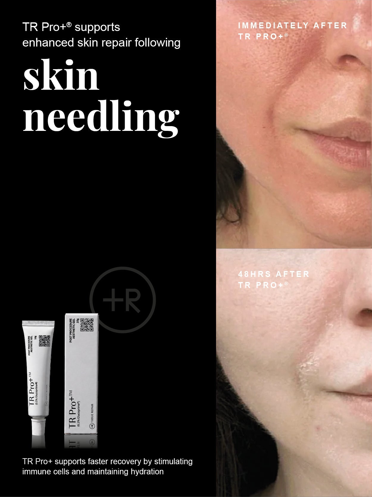 TR Pro+ Tissue Repair Hydrogel 10g