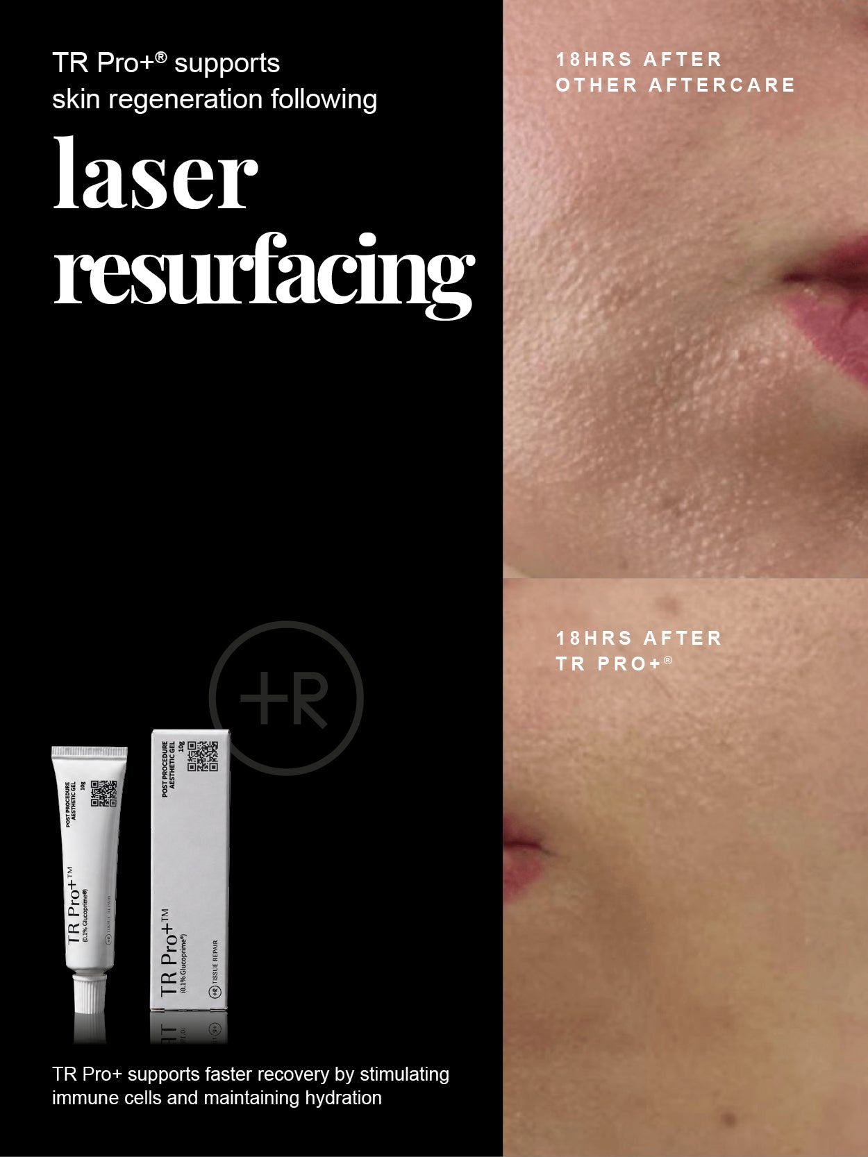 TR Pro+ Tissue Repair Hydrogel 10g