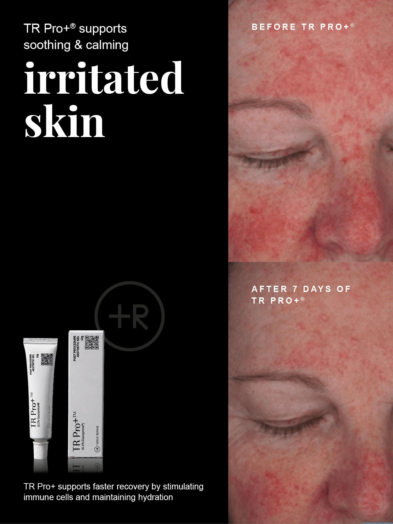 TR Pro+ Tissue Repair Hydrogel 10g