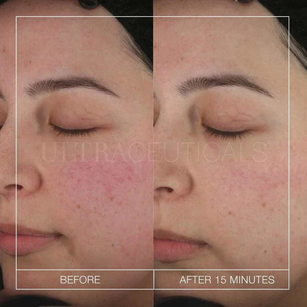 Ultraceuticals Ultra B2 Recovery Cream 50ml