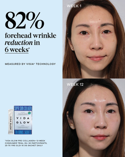 Vida Glow Pro Collagen+ Bonus Set - Limited Edition