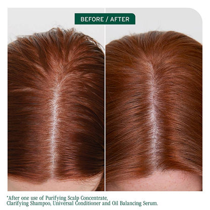 Biolage Biolage Scalp Sync Oil Balancing Serum 50ml Hair Oils & Serums