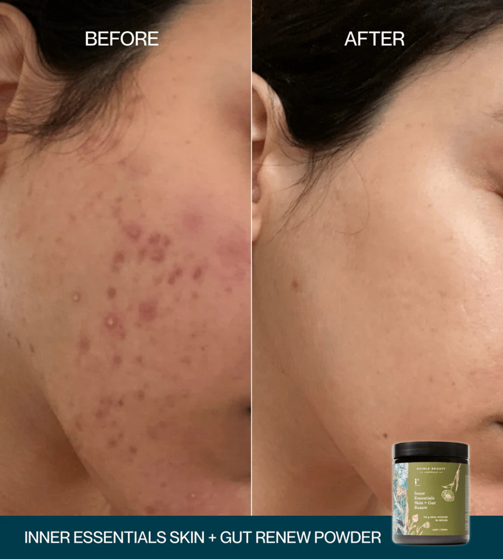 Edible Beauty Inner Essentials - Skin + Gut Renew Powder 120g