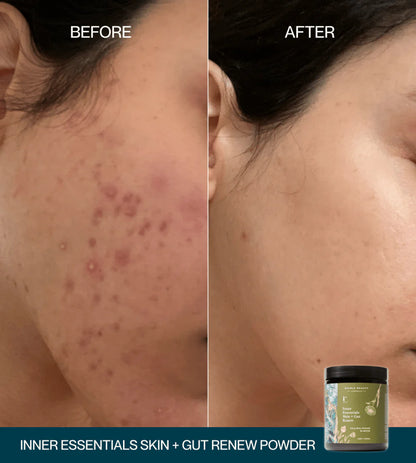 Edible Beauty Inner Essentials - Skin + Gut Renew Powder 120g