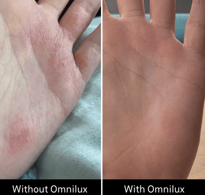 Omnilux Contour Glove